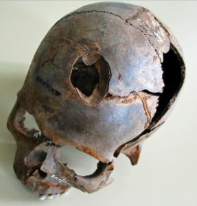 skull1.jpg